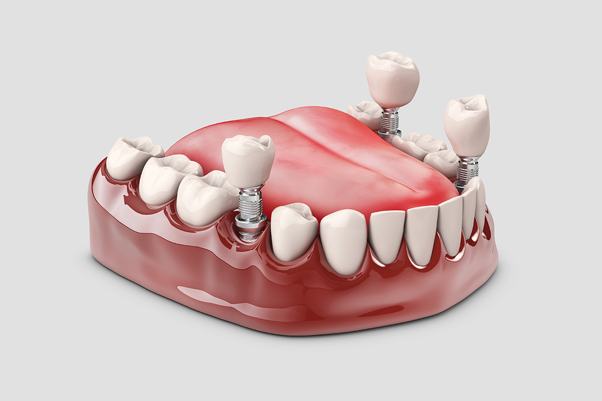 best dental doctor near me