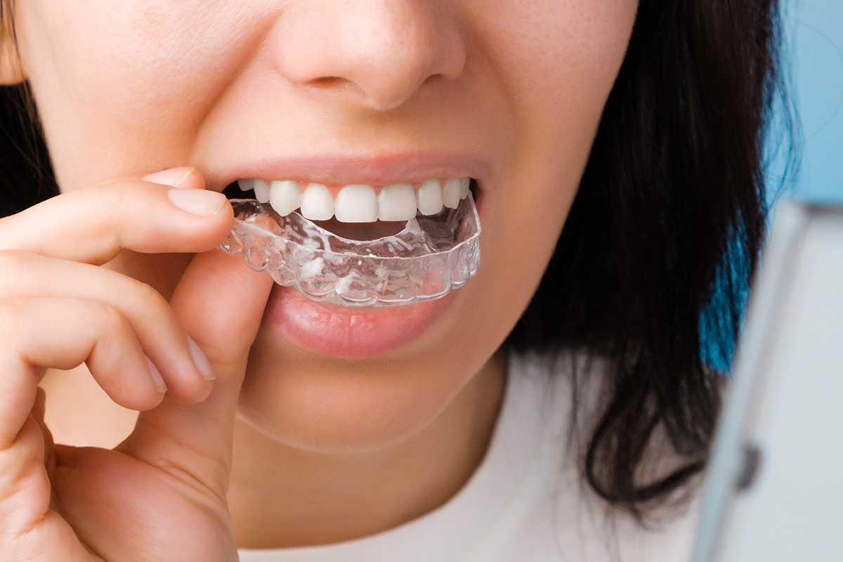 best dental clinic near me kphb